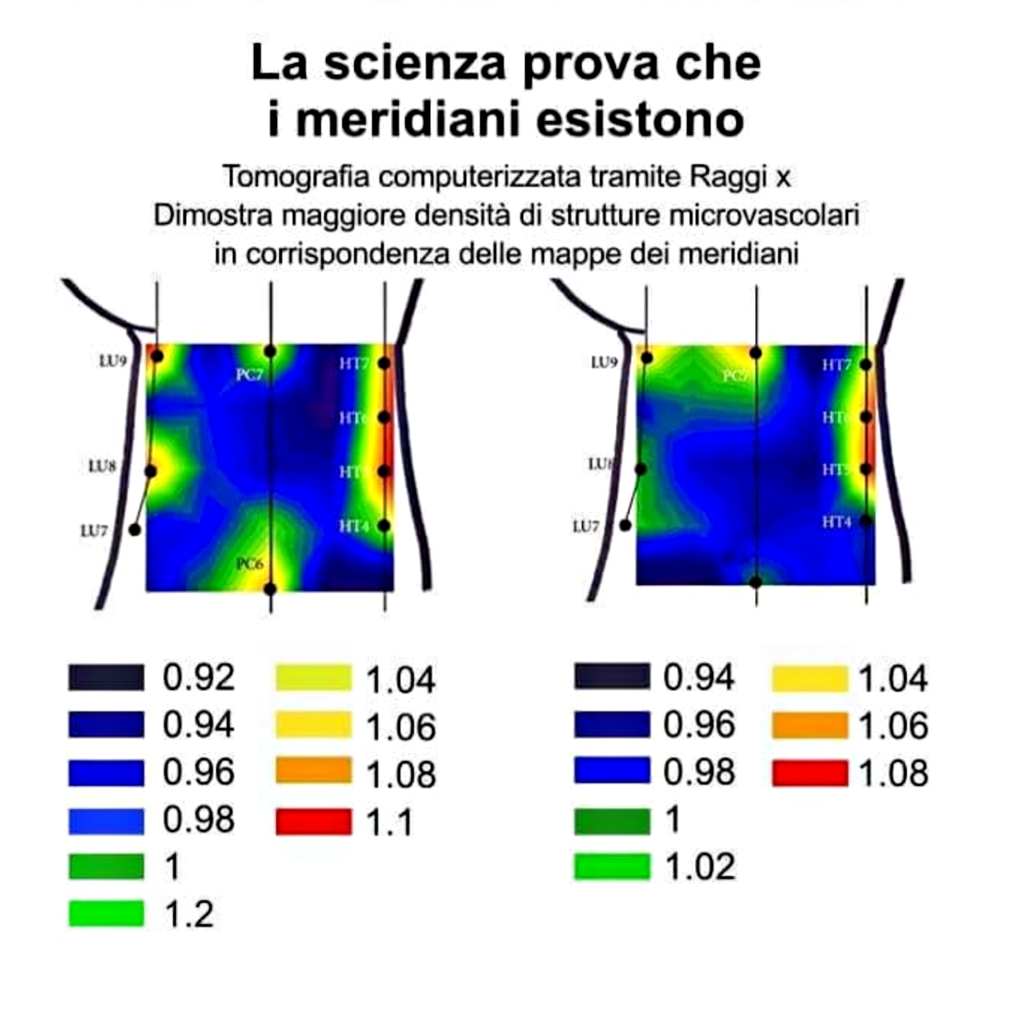 Tomografia computerizzata a raggi X